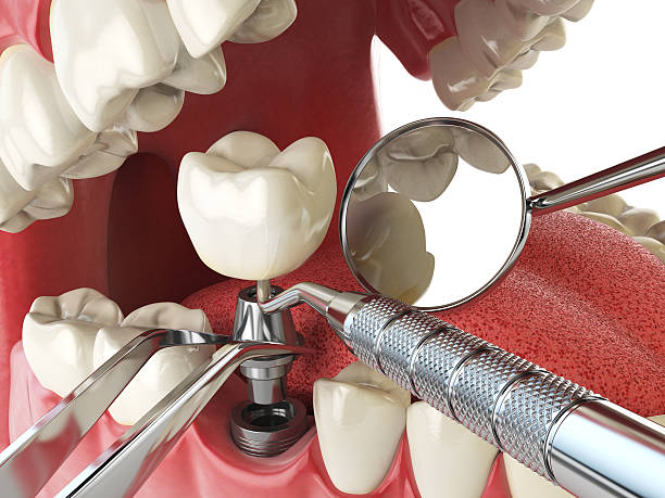 Best Root Canal Emergency Dentist  in Fort Bliss, TX